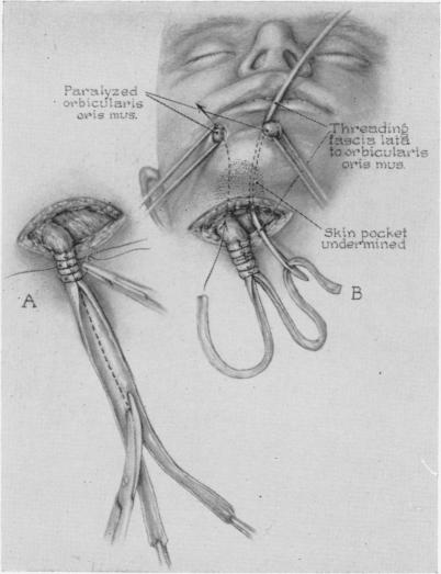 Fig. 11.