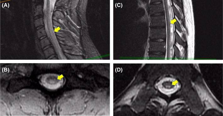 FIGURE 2