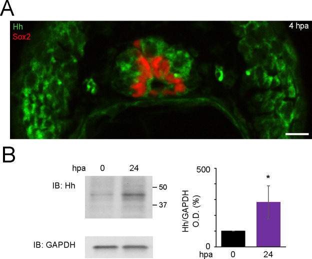 Figure 1—figure supplement 1.