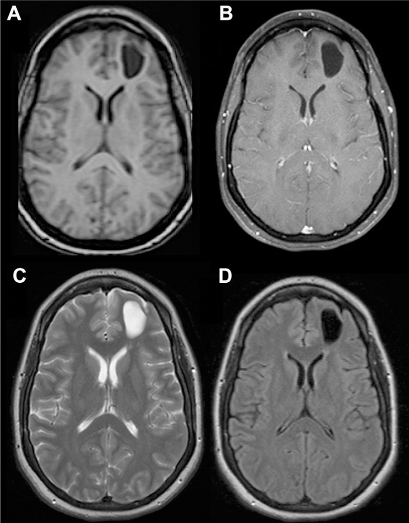 Fig 14.