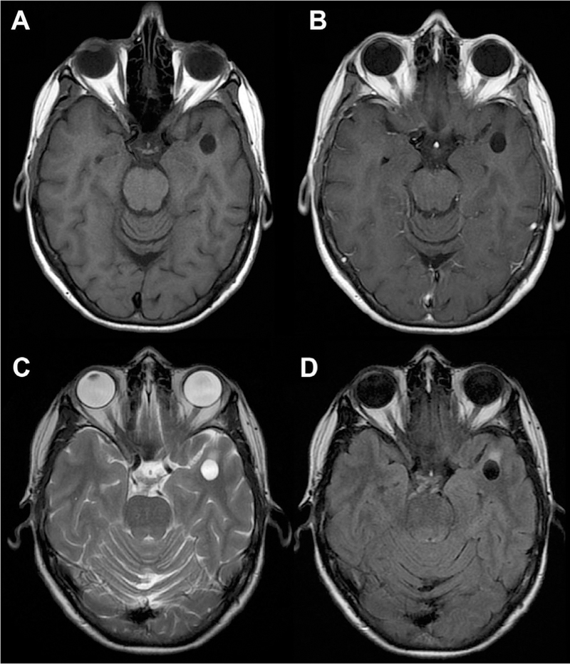 Fig 5.