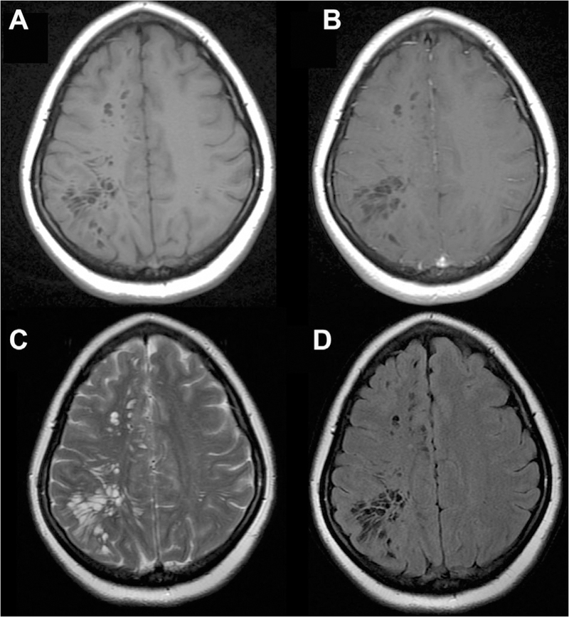 Fig 3.