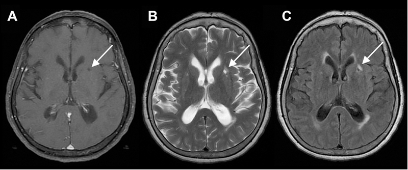 Fig 11.