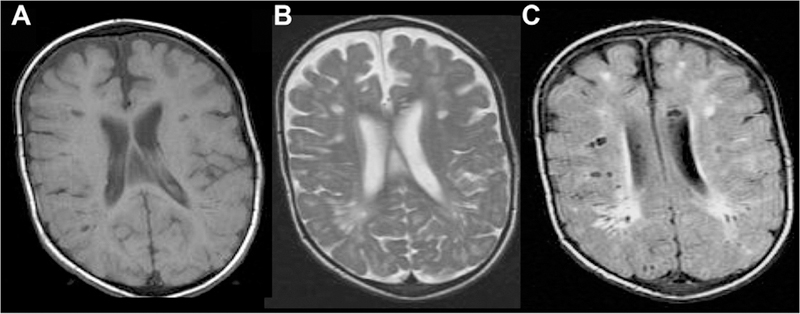 Fig 20.