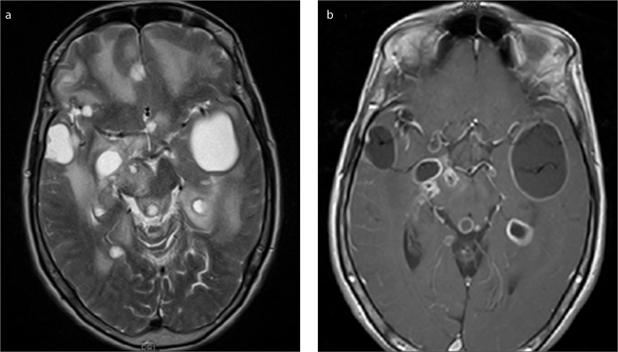 Figure 1. a, b.