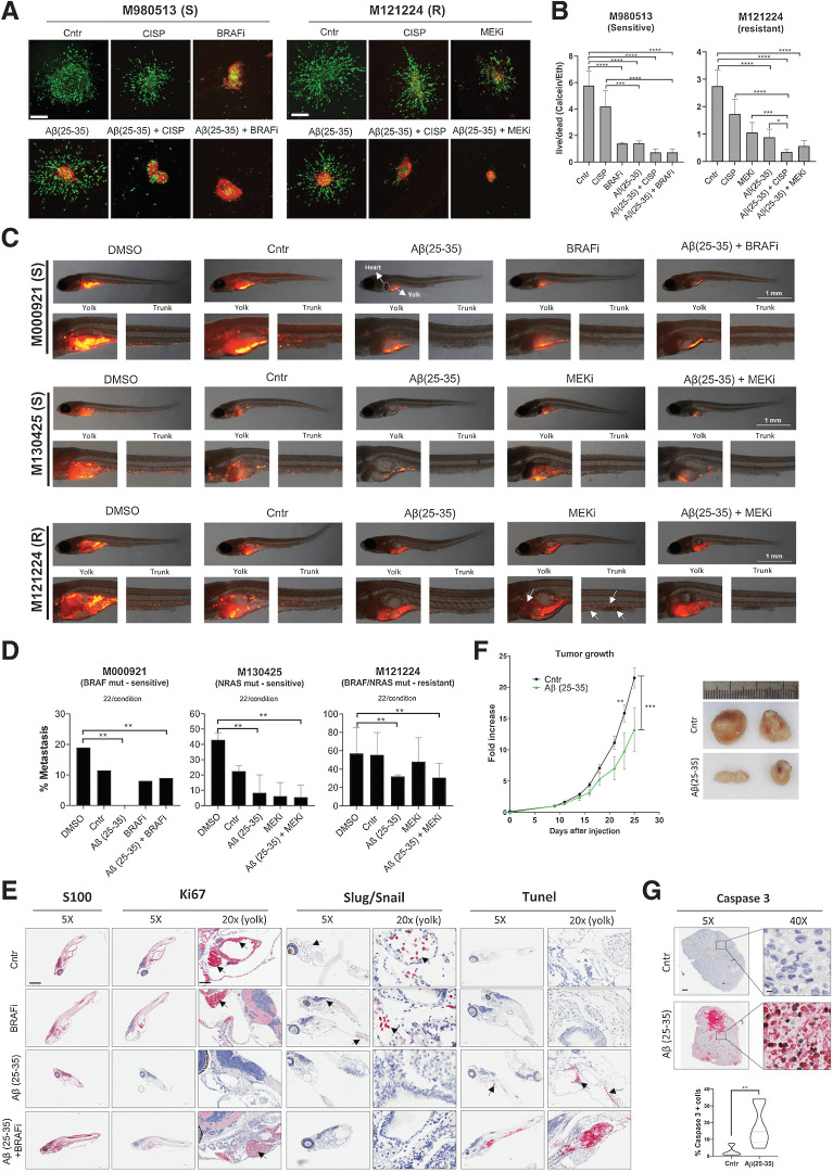 Figure 4. Aβ(25–35) prevents melanoma invasion and metastasis formation in vivo. A and B, M980513 (S, sensitive) and M121224 (R, resistant) spheres were implanted into a matrix of collagen I and treated with Aβ(25–35) 40 μmol/L ± cisplatin/BRAFi/MEKi. A total of 168 hours later, spheres were stained to evaluate the live (calcein; green)/dead (ethidium; red) cells. Scale bar, 30 μm. B, The live/dead ratio was analyzed in six spheres/condition by Photoshop. C, MAPKi-sensitive and resistant melanoma cells were stained with Vibrant Dye (red) and injected into the yolk of zebrafish larvae. Twenty-four hours later, zebrafish were treated with BRAFi/MEKi and Aβ(25–35) was injected into the yolk the day after. Pictures were taken 4 days later and the number of zebrafish with metastasis (D) was evaluated by two blind investigators. Data represent the mean ± SD of two independent experiments (tot = 660). One-way ANOVA was used for statistical analysis. **, P < 0.01; ***, P < 0.001. E, M000921-injected zebrafish were stained with S100, Ki67, Slug/Snail, and TUNEL. Scale bar, 500 μm (5×) and 100 μm (20×). F, A total of 500000 M121224 cells were subcutaneously injected in 9-weeks-old female nude mice. When tumor reached approximately 50 mm3, BSA or 15 μg Aβ(25–35) was intratumorally injected three times a week. Tumor growth was measured using an electronic caliper. Mice were sacrificed when control tumors reached 1,000 m3. Fold increase was calculated using each individual measure at day 7 to standardize. Representative images are shown (n = 5–8 tumors/group. G, Caspase-3 staining was performed on six tumors/group and quantified by QuPath. Scale bar, 4 mm (5×) and 200 μm (40×). Two-way Anova; **, P ≤ 0.01.
