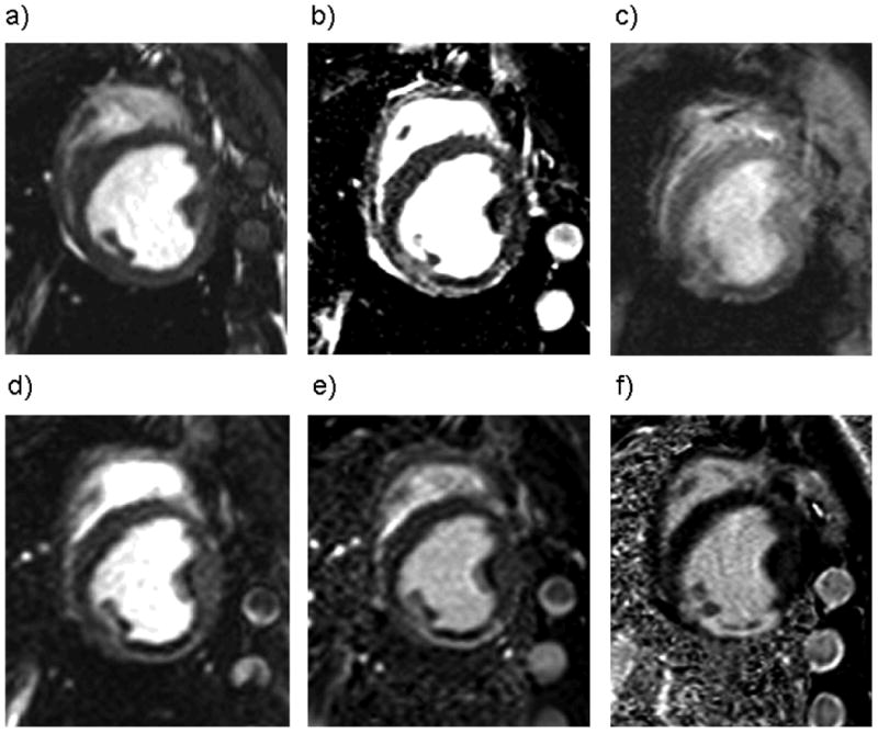 Figure 2a