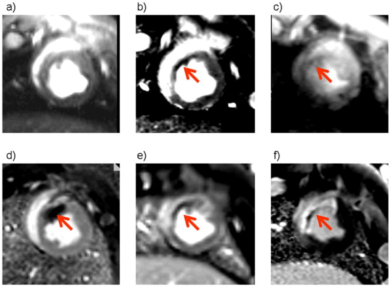 Figure 1a