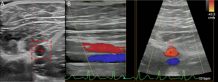 Fig. 3