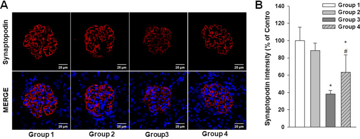 Fig. 11