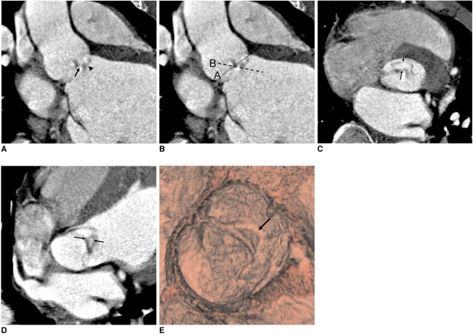 Fig. 5