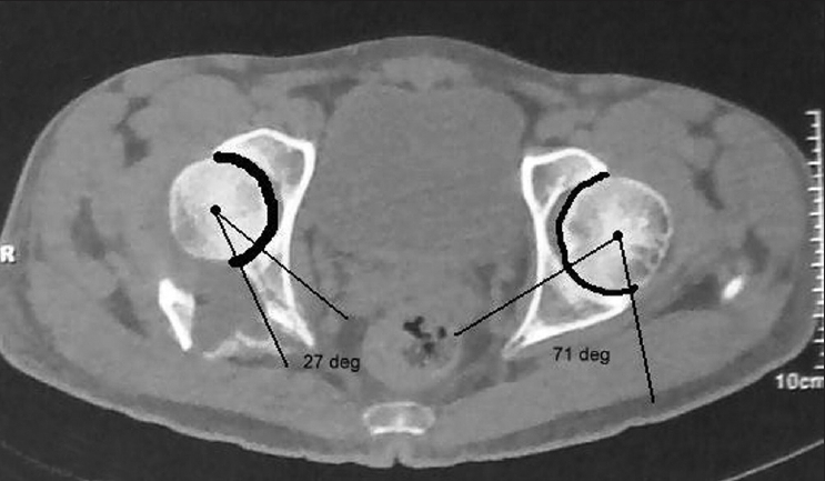 Figure 2B