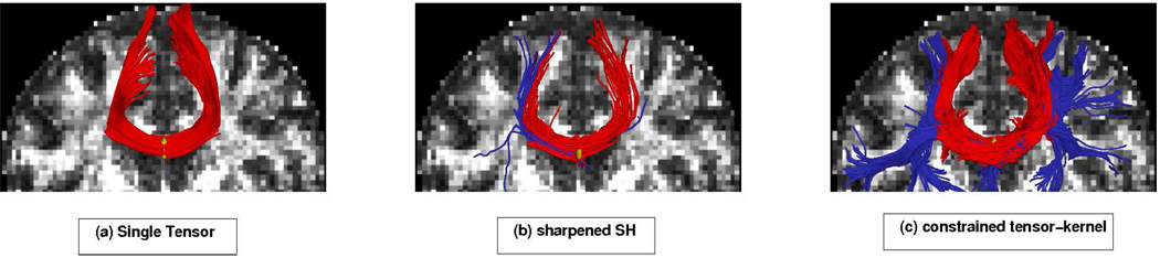 Fig 11