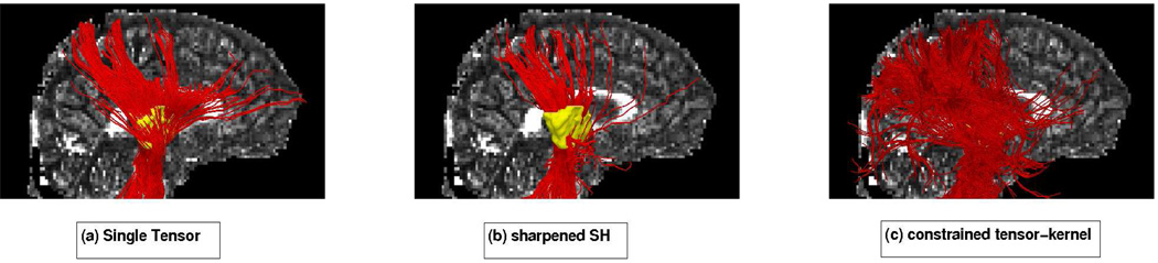 Fig 14