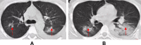 Fig. 7