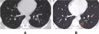 Fig. 5