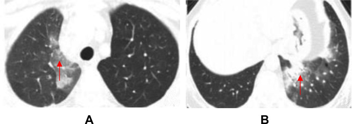 Fig. 6