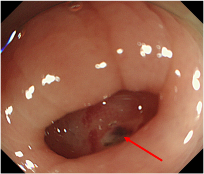 Fig. 2