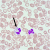 Fig. 2
