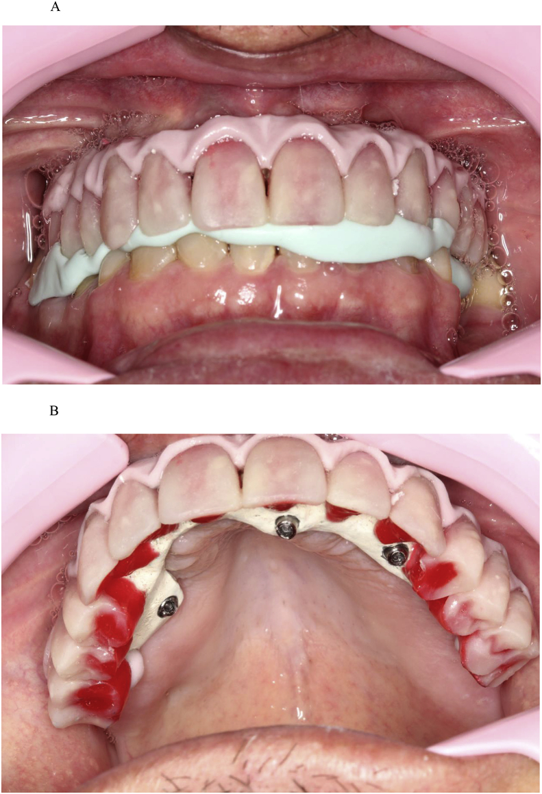 Fig. 6