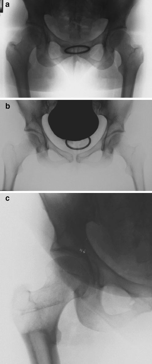 Fig. 2a–c