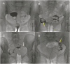 FIGURE 4