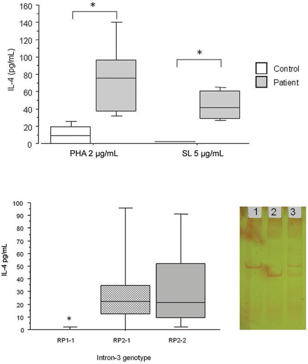 Production of interleukin (IL)-4 by peripheral blood mononuclear cells from
patients and control subjects stimulated with phytohaemagglutinin (PHA) or
crude soluble Paracoccidioides brasiliensis antigens (A) or on
all casuistic (patients and controls) grouped according to intron-3 genotype
(B). Horizontal lines represent the median, bars represent the 25-75%
percentiles and vertical line the 10-90% percentiles. Asterisk mean
significance with p < 0.05 Mann-Whitney U and
Kruskal-Wallis. Lateral panel of B: a representative polyacrylamide gel
electrophoresis of intron-3 polymorphism. Line 1: PR2-2; 2: RP1-1; 3: RP2-1.
RP1 correspond to 183 bp and RP2 correspond to 253 bp DNA fragments. SL:
streptolysin.