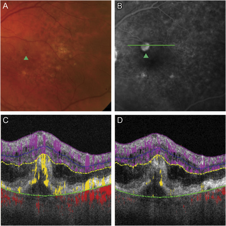 Fig. 1