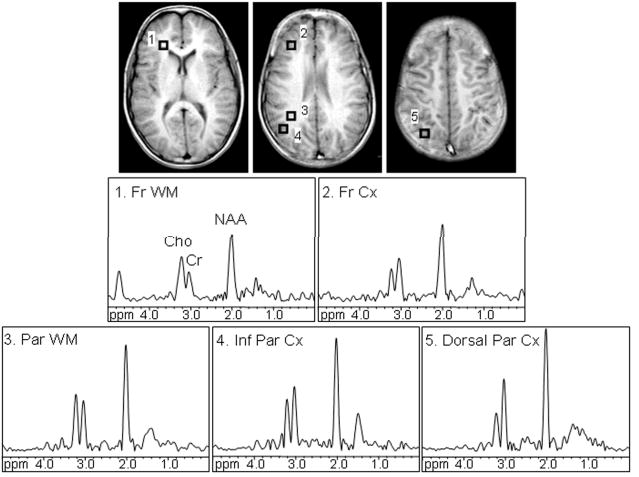 FIGURE 1