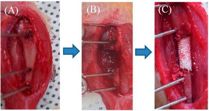 Figure 11