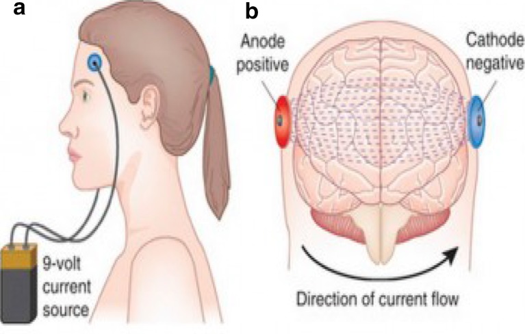 Fig. 2