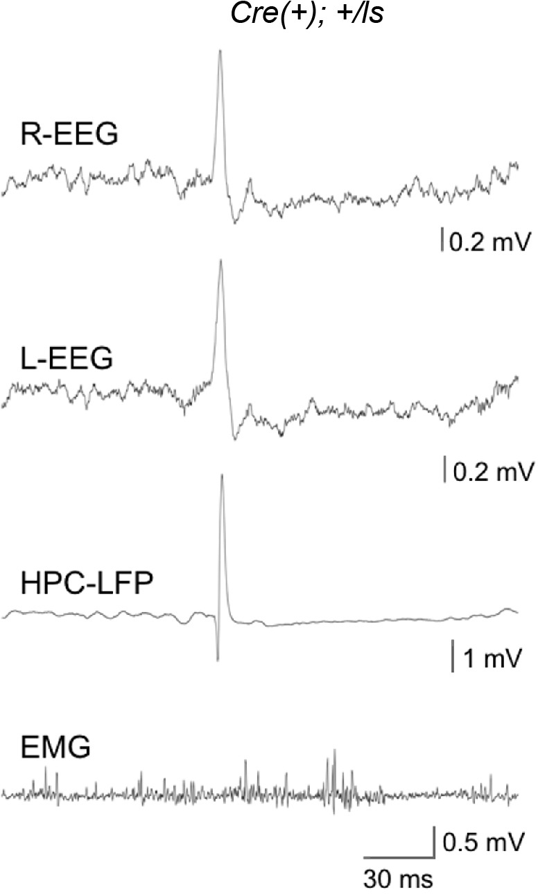 Figure 2—figure supplement 1.