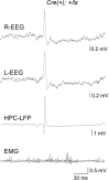 Figure 2—figure supplement 1.