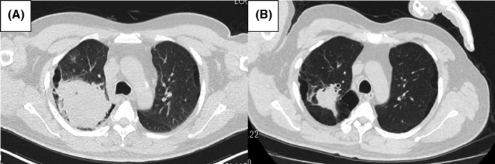 FIGURE 1