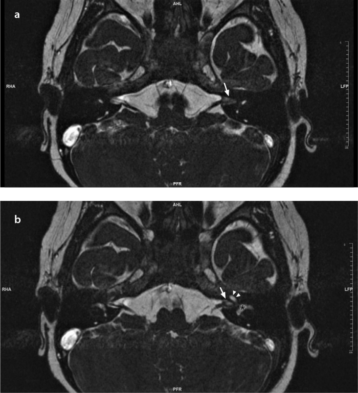 Figure 3. a, b