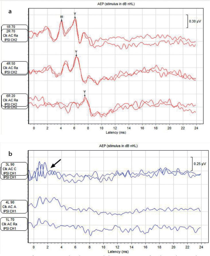 Figure 2. a, b