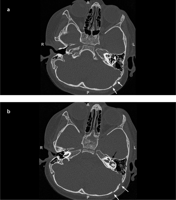 Figure 1. a, b