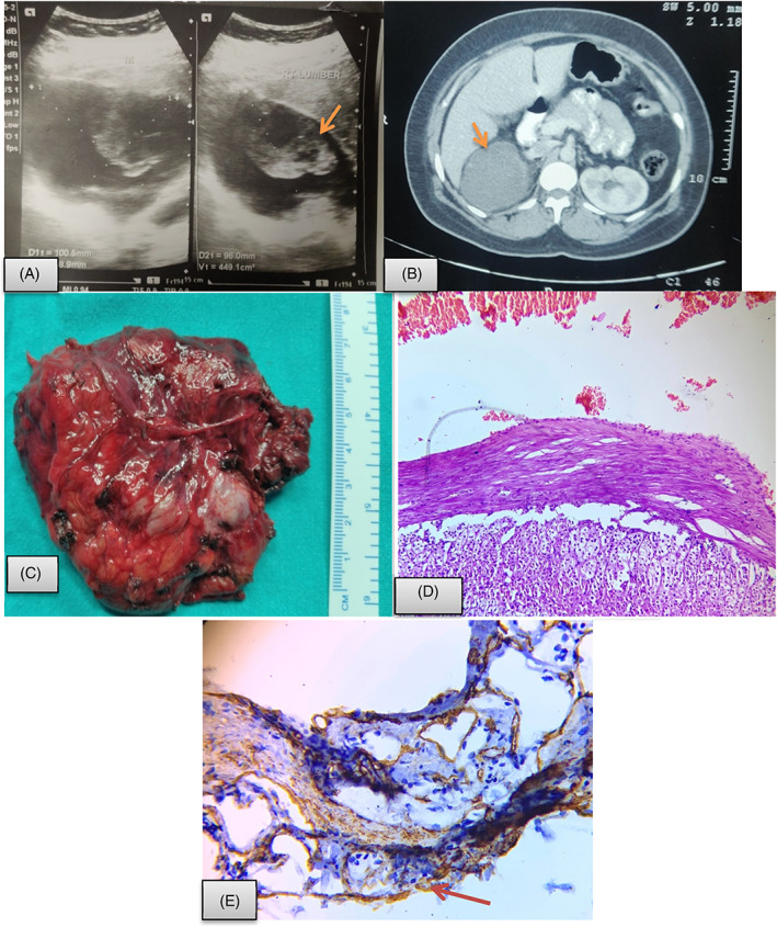 FIGURE 3