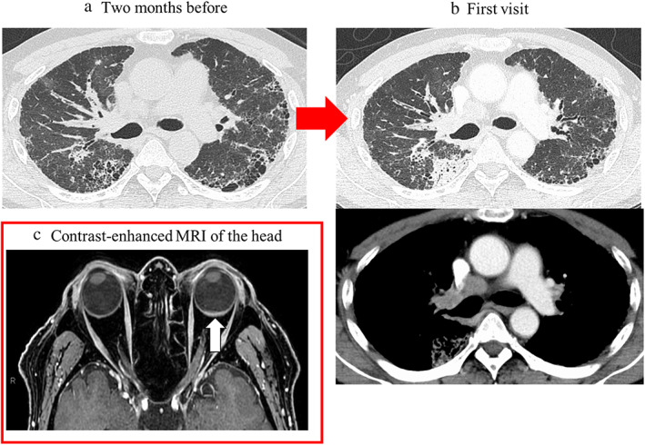 FIGURE 1