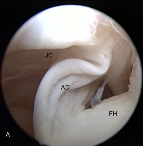 Fig. 2