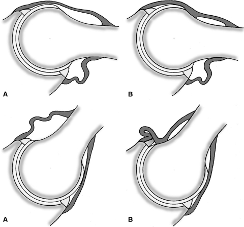 Fig. 4A–B