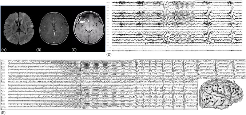 FIGURE 1