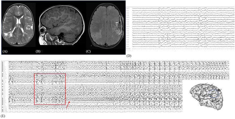 FIGURE 2