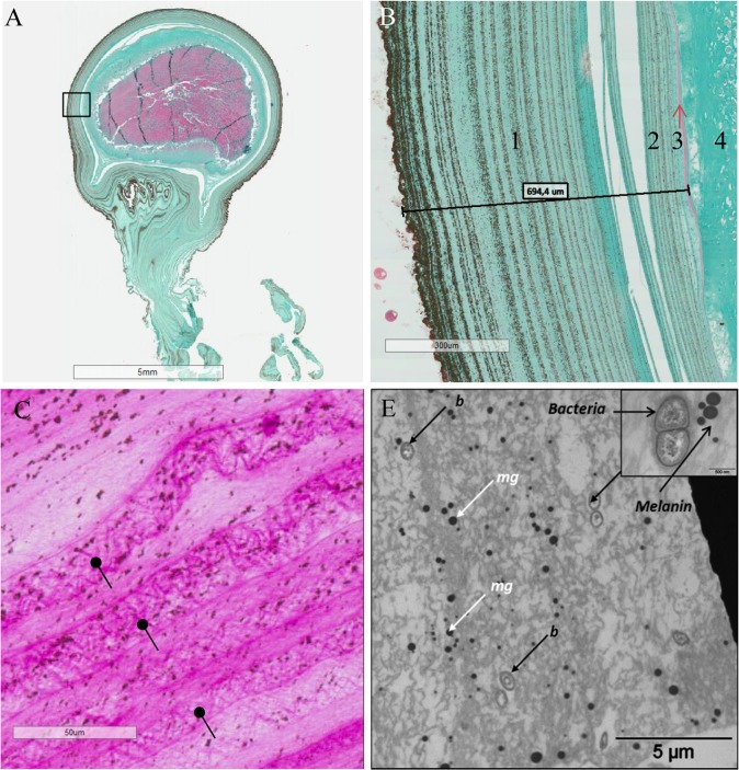 Fig 1