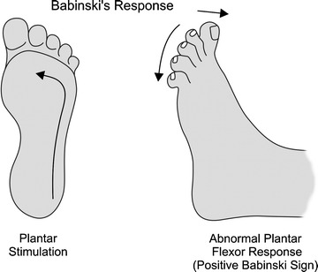 Fig. 2.2