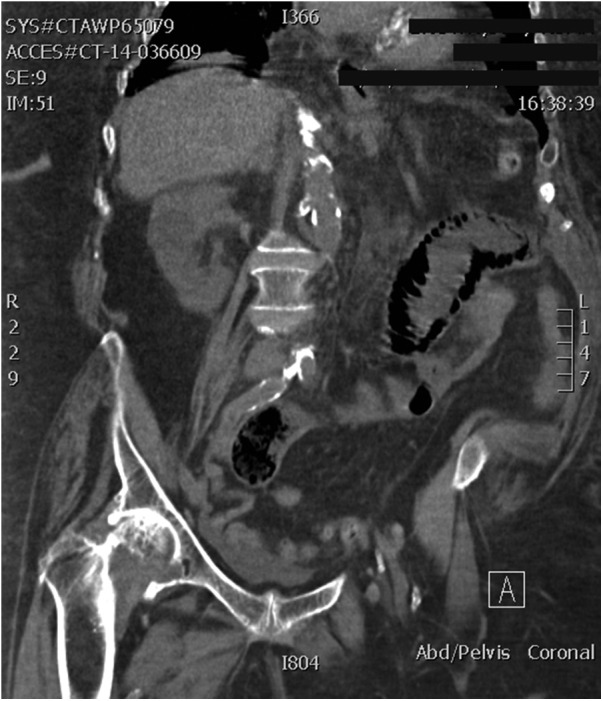 Figure 4