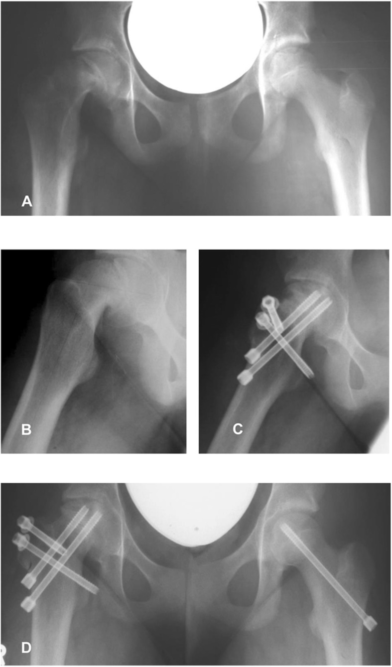 Fig. 2