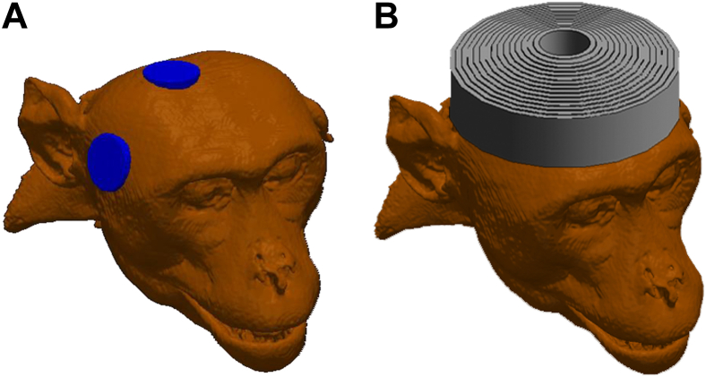 Figure 1