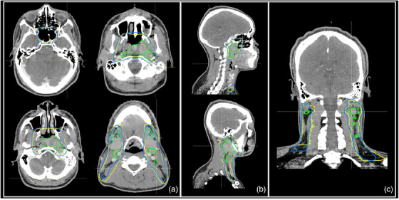 FIGURE 4