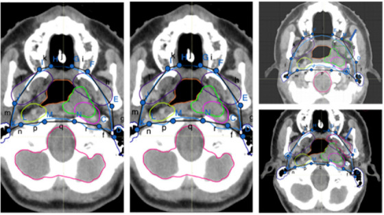 FIGURE 3